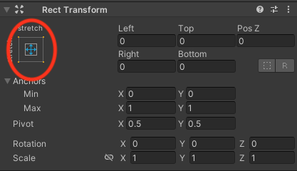 An image of the Unity UI highlighting the Anchor Prests button